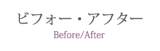 ビフォー・アフター